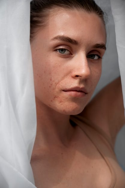 How to Get Rid of Acne Scars: A Comprehensive Guide